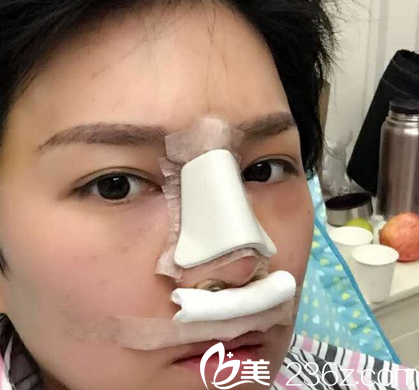 剛做完之后的我 剛做完之后的我