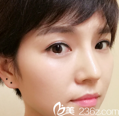 基本恢復(fù)了一個(gè)月的我 基本恢復(fù)了一個(gè)月的我