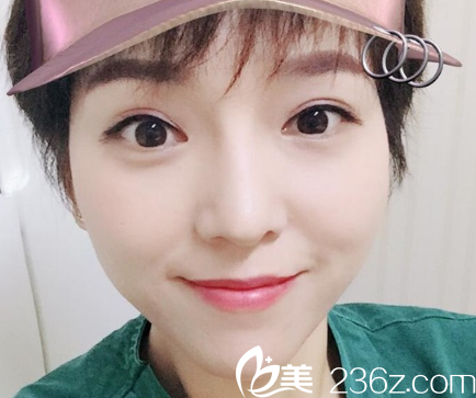 現(xiàn)在的鼻子真的是比較好看 現(xiàn)在的鼻子真的是比較好看