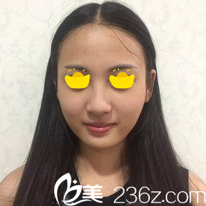 注射術(shù)前皮膚狀況 注射術(shù)前皮膚狀況