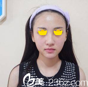 注射術(shù)后第2天 注射術(shù)后第2天