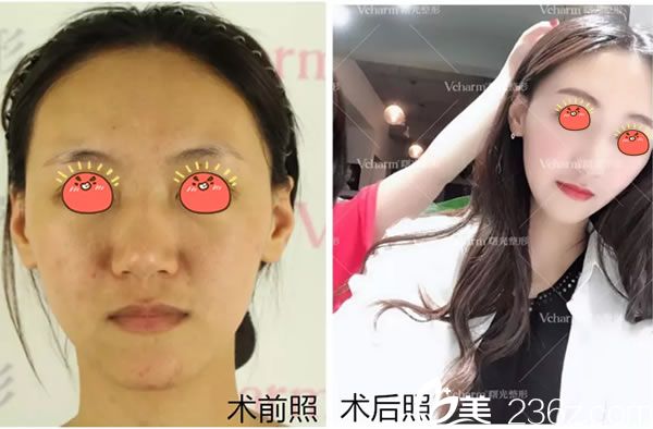 曙光明星臉真人案例效果圖 曙光明星臉真人案例效果圖