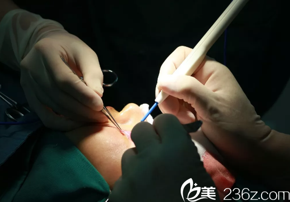 眼綜合整形手術(shù)中