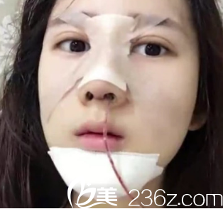 這個(gè)管子其實(shí)是有助于<span style= 這個(gè)管子其實(shí)是有助于<span style=