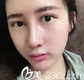 恢復(fù)了30天了 恢復(fù)了30天了