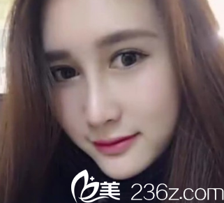 西安<!--<i data=20240703-sp></i>-->醫(yī)院整形科的醫(yī)生技術(shù)真的棒 西安<!--<i data=20240703-sp></i>-->醫(yī)院整形科的醫(yī)生技術(shù)真的棒