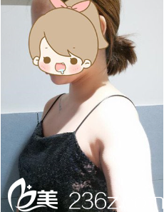 術前平胸的我 術前平胸的我