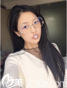 雖說去貴陽美萊整形錢剛那兒做面部吸脂恢復過程有點難熬，但效果我不得不服。