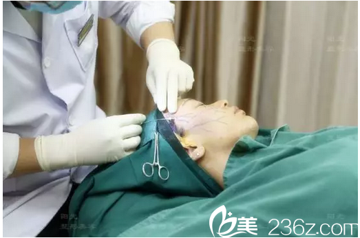 <!--<i data=20240703-sp></i>-->6d面部治療過程圖