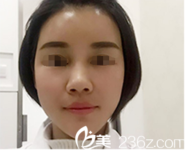 做完脂肪填充術后三天恢復 做完脂肪填充術后三天恢復