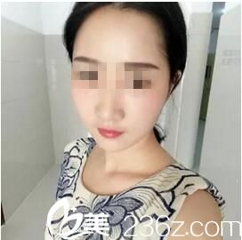 感謝曲靖吳氏嘉美用自體脂肪填充我的額頭和太陽(yáng)穴 不僅解決了凹陷還讓我的臉恢復(fù)水嫩感