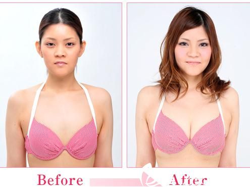 20181101_1541057477459663.jpg 豐胸.jpg