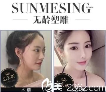 長沙芯美昕無齡塑雕真人案例展示