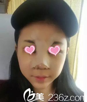 術(shù)后三天 術(shù)后三天