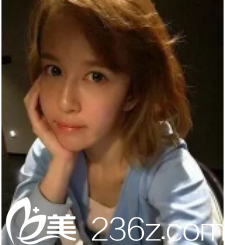 云南華美美萊美容醫(yī)院自體脂肪豐胸術(shù)前照 云南華美美萊美容醫(yī)院自體脂肪豐胸術(shù)前照