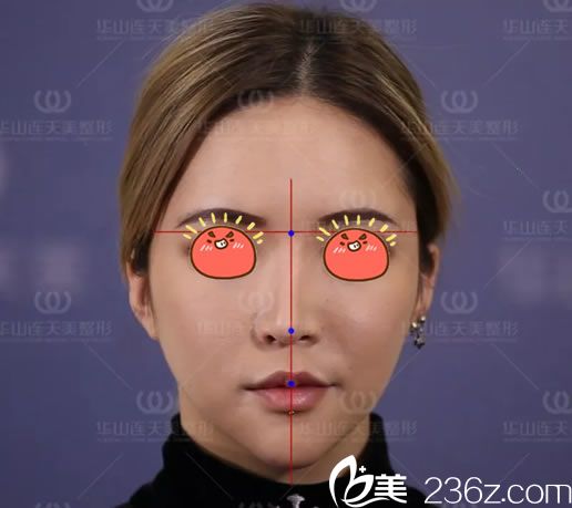 做4個(gè)鼻綜合手術(shù)都失敗的照片 做4個(gè)鼻綜合手術(shù)都失敗的照片