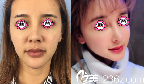 昆明夢想鼻修復(fù)案例