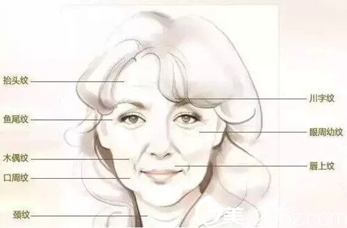 PPDO面雕提拉的有效部位 PPDO面雕提拉的有效部位