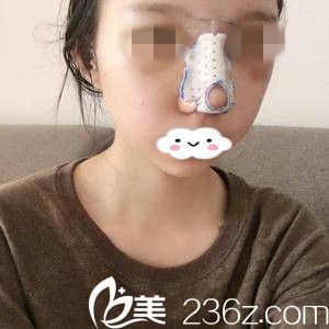 術后第二天 術后第二天