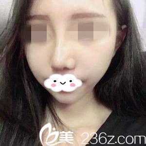 拆線后天 拆線后天