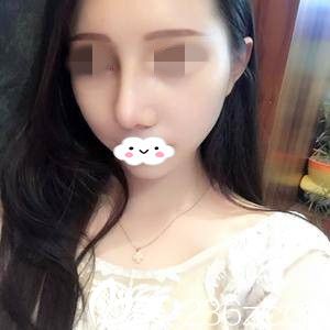 術后半個月 術后半個月