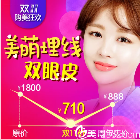 廣州美萊雙11優(yōu)惠價(jià)格表公布全場(chǎng)3.6折 雙眼皮710元,隆鼻3600元,隆胸15840元
