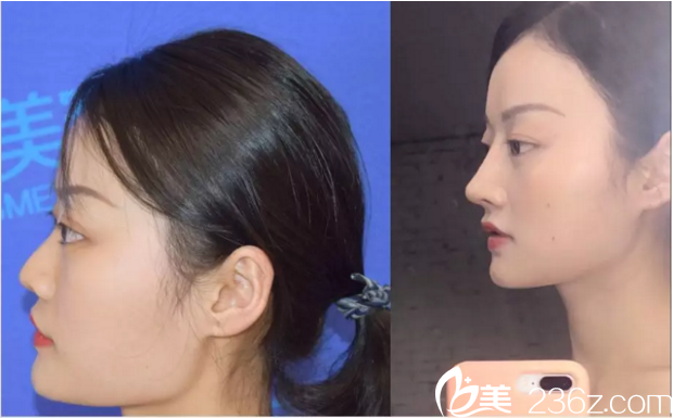 真人案例零距離展示