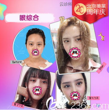 北京美萊眼綜合<span style=