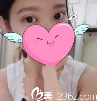 術(shù)后15天的樣子 術(shù)后15天的樣子