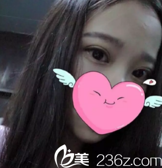 術(shù)后20天 術(shù)后20天