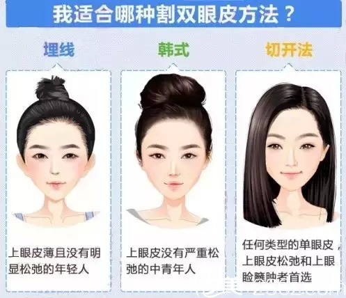 常見的三種雙眼皮手術(shù)方法 常見的三種雙眼皮手術(shù)方法