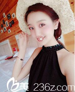 <!--<i data=20240703-sp></i>-->美萊自體脂肪全臉填充術(shù)后半個(gè)月 <!--<i data=20240703-sp></i>-->美萊自體脂肪全臉填充術(shù)后半個(gè)月