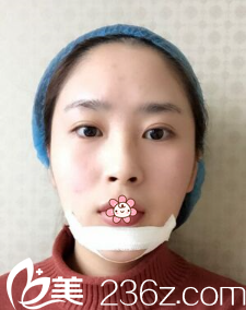 手術(shù)后第二天 手術(shù)后第二天