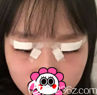 術(shù)后當(dāng)天