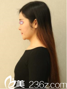 術(shù)前平胸的我 術(shù)前平胸的我