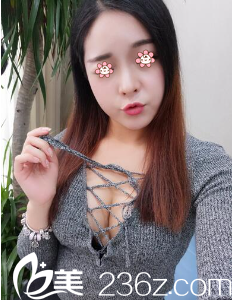 周誠(chéng)自體脂肪豐胸術(shù)后40天 周誠(chéng)自體脂肪豐胸術(shù)后40天