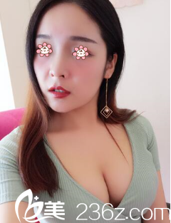 昆明美伊萊整形周誠(chéng)自體脂肪豐胸術(shù)后三個(gè)月 昆明美伊萊整形周誠(chéng)自體脂肪豐胸術(shù)后三個(gè)月