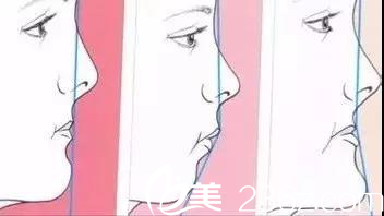 面部輪廓示意圖