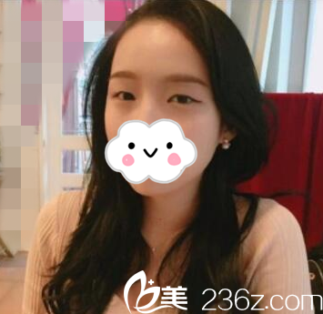 手術(shù)前的我 手術(shù)前的我