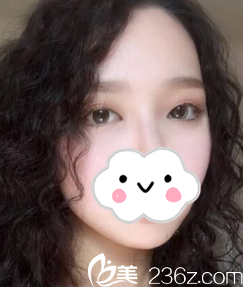 術(shù)后一周的效果 術(shù)后一周的效果