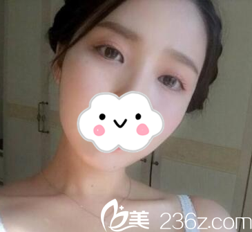 術(shù)后半個月 術(shù)后半個月