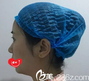 術(shù)前鼻子塌平 術(shù)前鼻子塌平