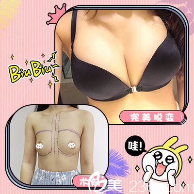 廣州可玫爾醫(yī)療美容<!--<i data=20240703-sp></i>-->誠做的隆胸 廣州可玫爾醫(yī)療美容<!--<i data=20240703-sp></i>-->誠做的隆胸