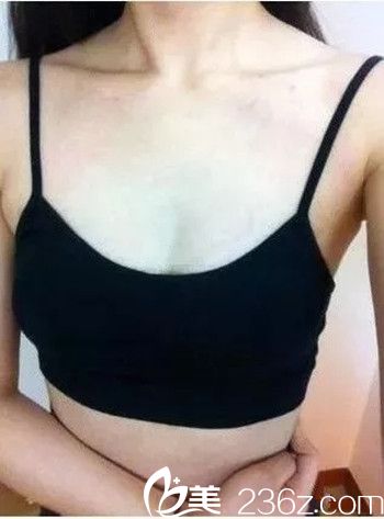 手術(shù)前照片 手術(shù)前照片