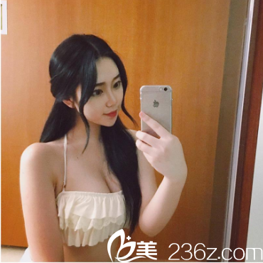 隆胸案例告訴你深圳富華唐新輝隆胸怎么樣 隆胸案例告訴你深圳富華唐新輝隆胸怎么樣