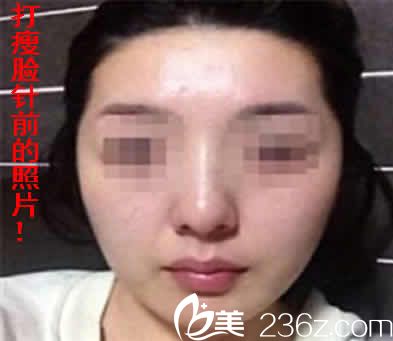 我在運城華美整形大瘦臉前的照片 我在運城華美整形大瘦臉前的照片