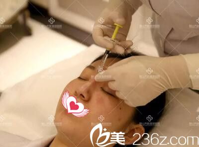 玻尿酸隆鼻手術(shù)過程中 玻尿酸隆鼻手術(shù)過程中