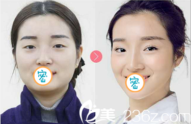 芭比電眼真人案例 芭比電眼真人案例