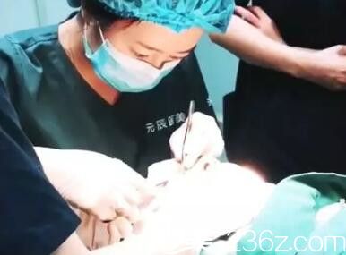 元生態(tài)雙眼皮+開眼角手術(shù)過程中 元生態(tài)雙眼皮+開眼角手術(shù)過程中