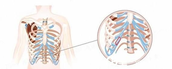肋軟骨的取材位置